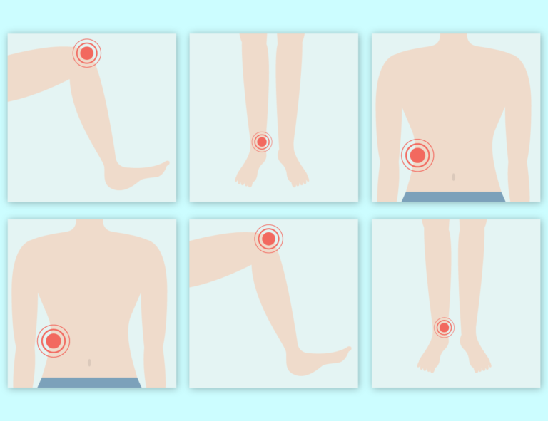 Stopa, kolano, biodro – przyczyny bólu i metody zapobiegania